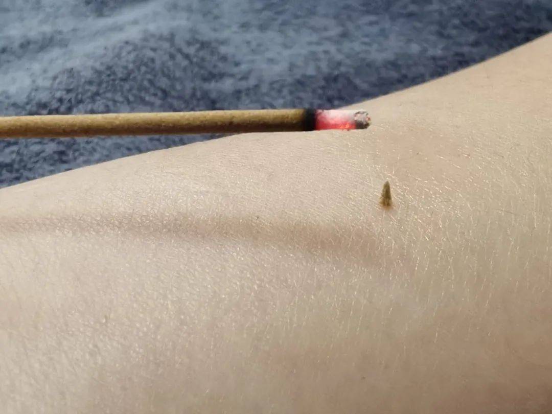 皇冠信用網代理出租
_醒来“天塌了”皇冠信用網代理出租
！深圳一女子眼睛闭不上、嘴巴漏水！这些错误很多人会犯
