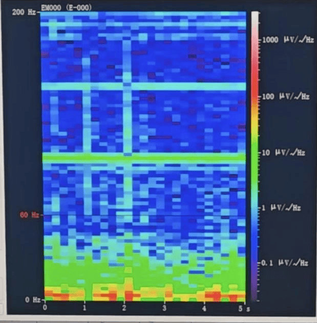 皇冠信用网会员
_山西首例皇冠信用网会员
!山西省人民医院成功实施脑机接口辅助功能区脑肿瘤切除手术